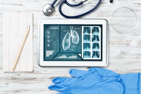 Medical diagnostics in modern pulmonology. Tablet computer with medical application interface on screen. Top view stethoscope and cardiogram on wooden desk. Digital tuberculosis screening testの写真素材
