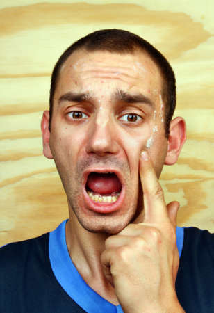 Young man with a chronic infection of the skin on the face