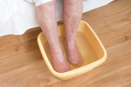 Old woman soaking feet in a bowl of water.の写真素材