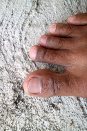 Photo of a man's toes with dark brown skin, with slightly dirtyの写真素材