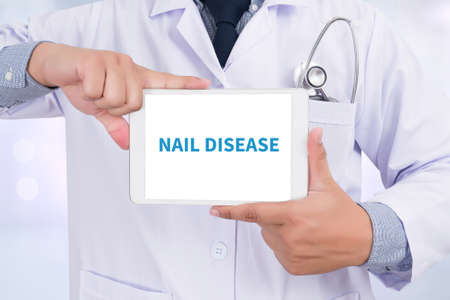 NAIL DISEASE Doctor holding  digital tabletの写真素材