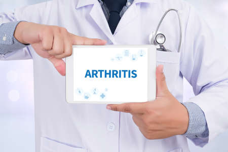ARTHRITIS Doctor holding  digital tabletの写真素材