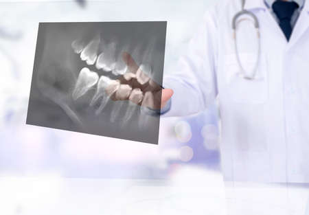 Dental x-ray Doctor holding and looking and Healthcare medicineの写真素材