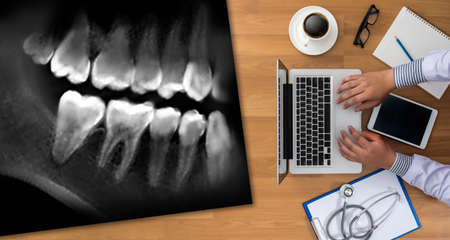 Dental x-ray Doctor holding and looking and Healthcare medicineの写真素材