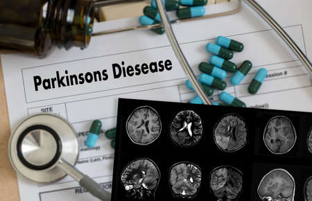 Parkinsons Disease doctor hand working Professional doctorの写真素材