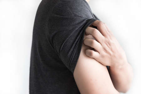 Itchy arms scratching Healthcare And Medicine Health problemの写真素材