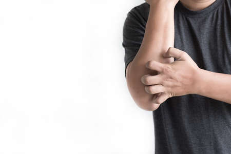 itchy  arms scratching  Healthcare And Medicine Health problem