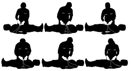 Black Solid 12 Lead ECG Placement Silhouettes Set of Six on White Background isolated on plain white...