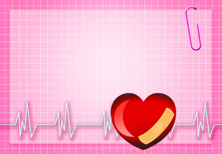 Electrocardiogram