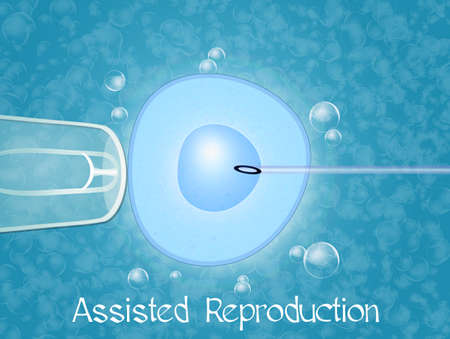 assisted reproductionの写真素材