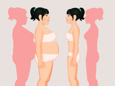 illustration of obese girl after dietの写真素材