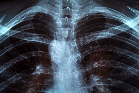 Chest X-ray image for physician's examination