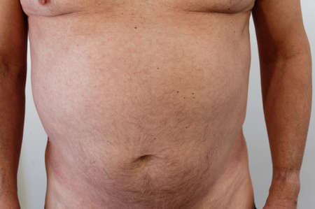 Fat deposits around the male chest and bellyの写真素材