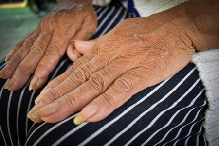 hand of the sick old woman rests on the lap. Mental health care at home.