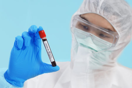 Close up on Blood Sample of SARS-CoV-2 , Covid-19 Positive on Eyes of Scientist Background.