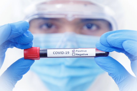 Close up on Blood Sample of SARS-CoV-2 , Covid-19 Positive on Eyes of Scientist Background.の写真素材