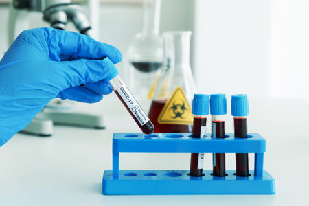 Hand of Scientist working in Lab while Checking Result of Blood Sample testing. Blue Tone....