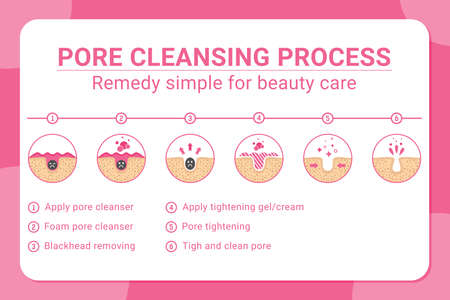 Vector banner 6 tips for blackheads removing and pore cleansing process. Acne or blackhead pore cleansing process with remedy simple for beauty care in isolated white background. Design for skincareのイラスト素材