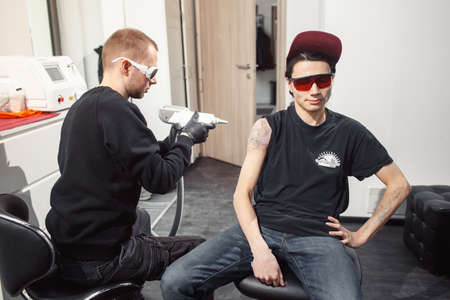 laser tattoo removal from armの写真素材