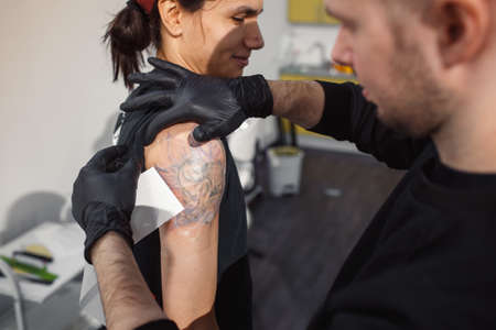 laser tattoo removal from arm