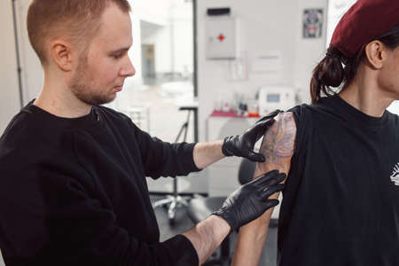 laser tattoo removal from armの写真素材