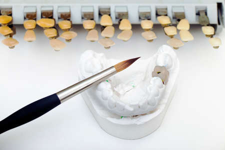 Technical shots of model on a dental prothetic laboratory  with accent in brush and ceramic tooth