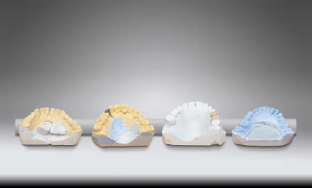 Technical shots of four models on a dental prothetic laboratory