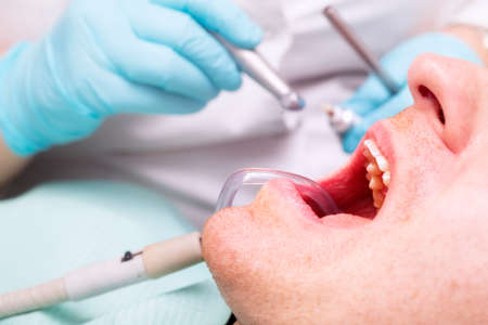 Dentist's hand with a glove and dentist's tools  in a patient mouthの写真素材