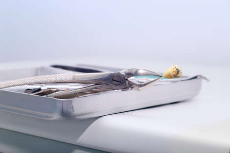 Close view of dental pliers holding a wisdom tooth with an amalgam sealの写真素材
