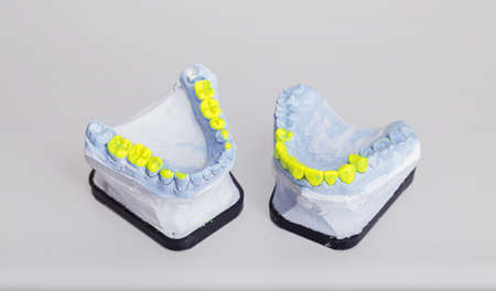 Technical shots of model on a dental prothetic laboratory 