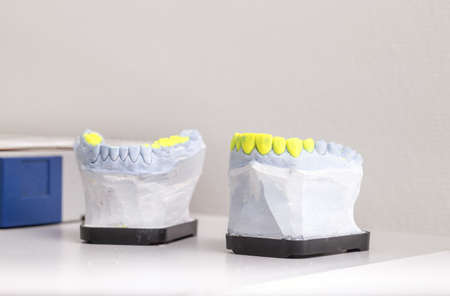 Technical shots of model on a dental prothetic laboratory 