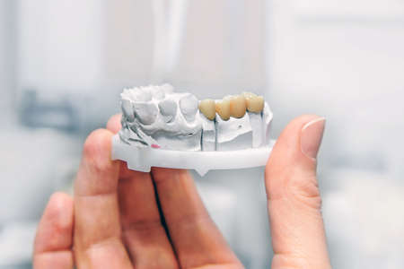 Technical shots of model on a dental prothetic laboratory.Dentist hand with plaster model and...