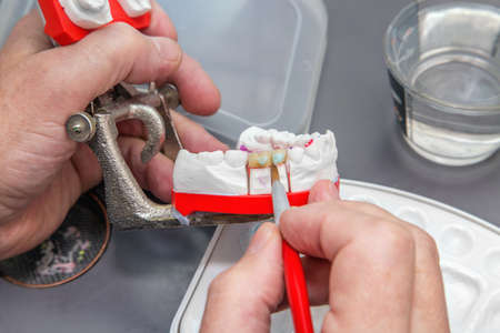Dentist hands with brush working on ceramic dental model. Close up.の写真素材