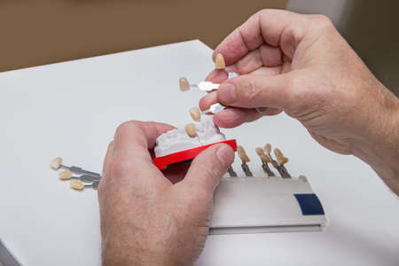 Dentist hands with color guide and  plaster model with porcelain tooth