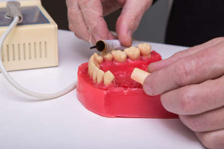 Close up of menâs hands working with electric waxer on a red wax dental model on a white tableの写真素材