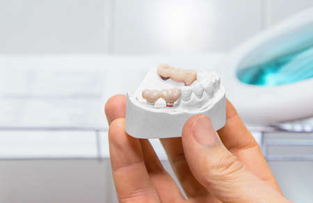 Technical shots of model on a dental prothetic laboratory. Close up.