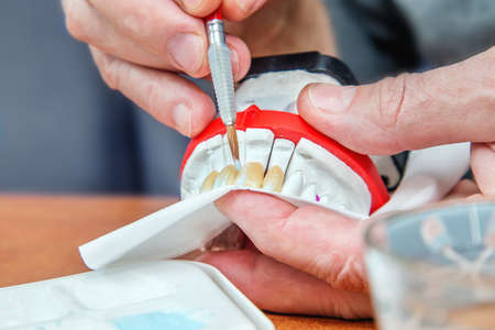 Dentist hands with brush working on ceramic dental model. Close up.の写真素材