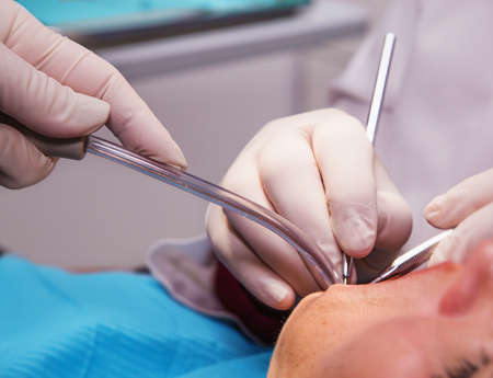 Dentistâs hands with tools making hygiene in a patient's mouth. Close up.の写真素材