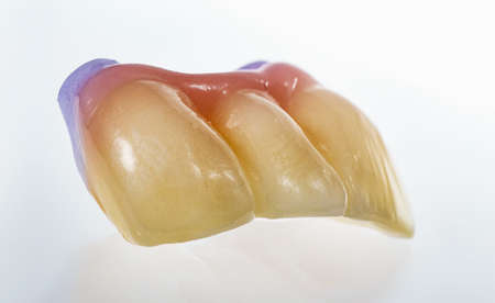Technical shots of tooth prosthesis on a dental prothetic laboratory. On a white bacjground. Close...