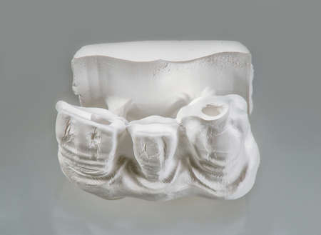 Technical shots of plaster model on a dental prothetic laboratory. On a white bacjground. Close up.の写真素材