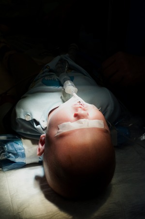 Siberia, Russia - September, 2015: Little boy laying on the operating table after a plastic surgery on the lip.のeditorial素材