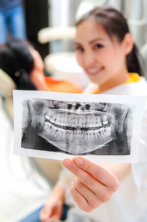 Dentist looking at x-ray picture in the officeの写真素材