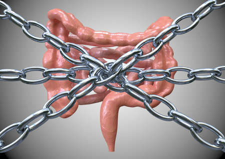 concept of constipation, currents holding bowel, difficulty expelling stool. 3D rendering