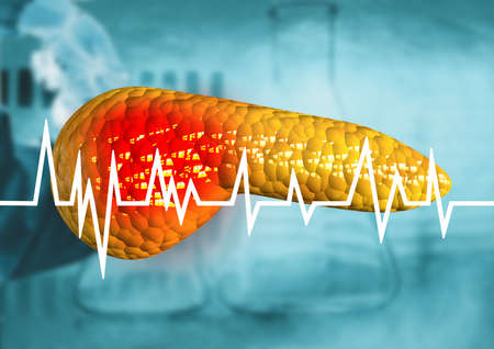 pancreas, human body organ with diagnosis of cancer, pancreatitis, serious diseases. 3D renderingの写真素材