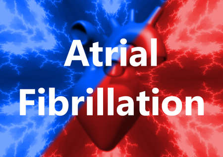 Letter atrial fibrillation, human heart abnormal heart rhythm. 3D renderingの写真素材