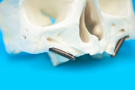 medical skull pattern with false teeth pins on a blue background