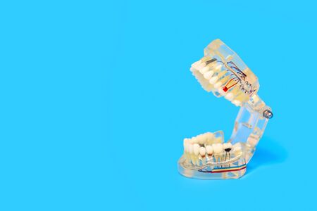 the training model of the jaw and teeth to the dental office on a blue backgroundの写真素材