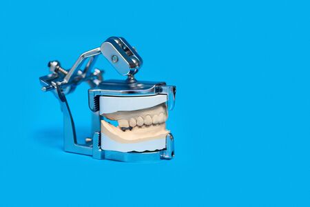 jaw cast in a special medical device on a blue backgroundの写真素材