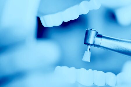 reception in the dentist's office, cleaning the enamel of teeth