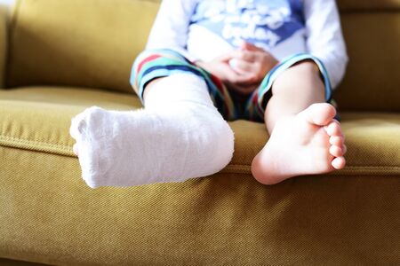 Little child with plaster bandage on leg heel fracturedの写真素材